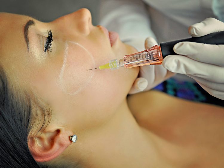 NU'CLINIC-Výplň líc kyselinou hyalurónovou