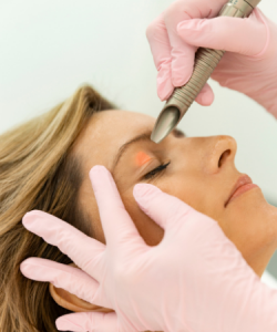 NU'CLINIC–SmoothEye–spevnenie viečok a očného okolia laserom