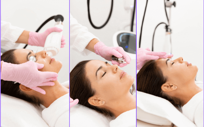 Omladenie a vyhladenie pleti - BabyFaceBeauty-LaseMD - ošetrenie laserom