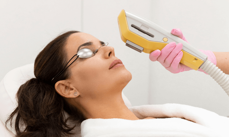 NU'CLINIC–Omladenie pleti intenzívnym pulzným svetlom (IPL)